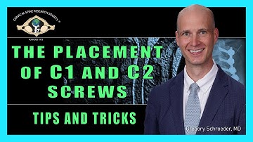 Placement of C1 and C2 Screws - Tips and Tricks