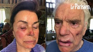 Cambriolage violent de Bernard et Dominique Tapie: les images des blessures du couple