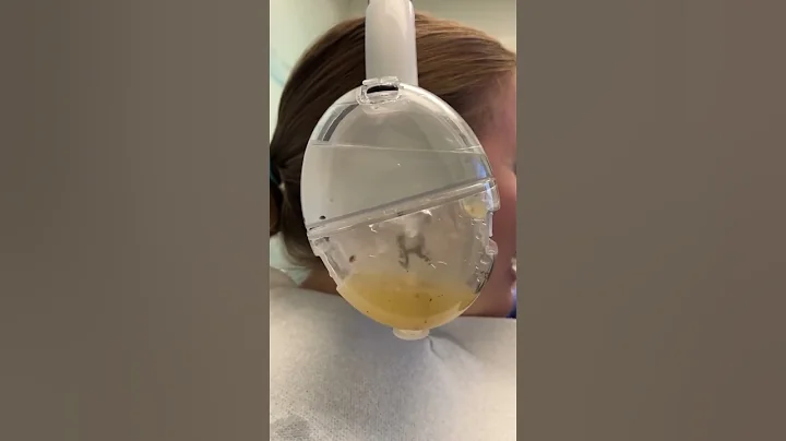 These ear cleaning headphones are incredible 😮 (🎥: ig/tryotoset)