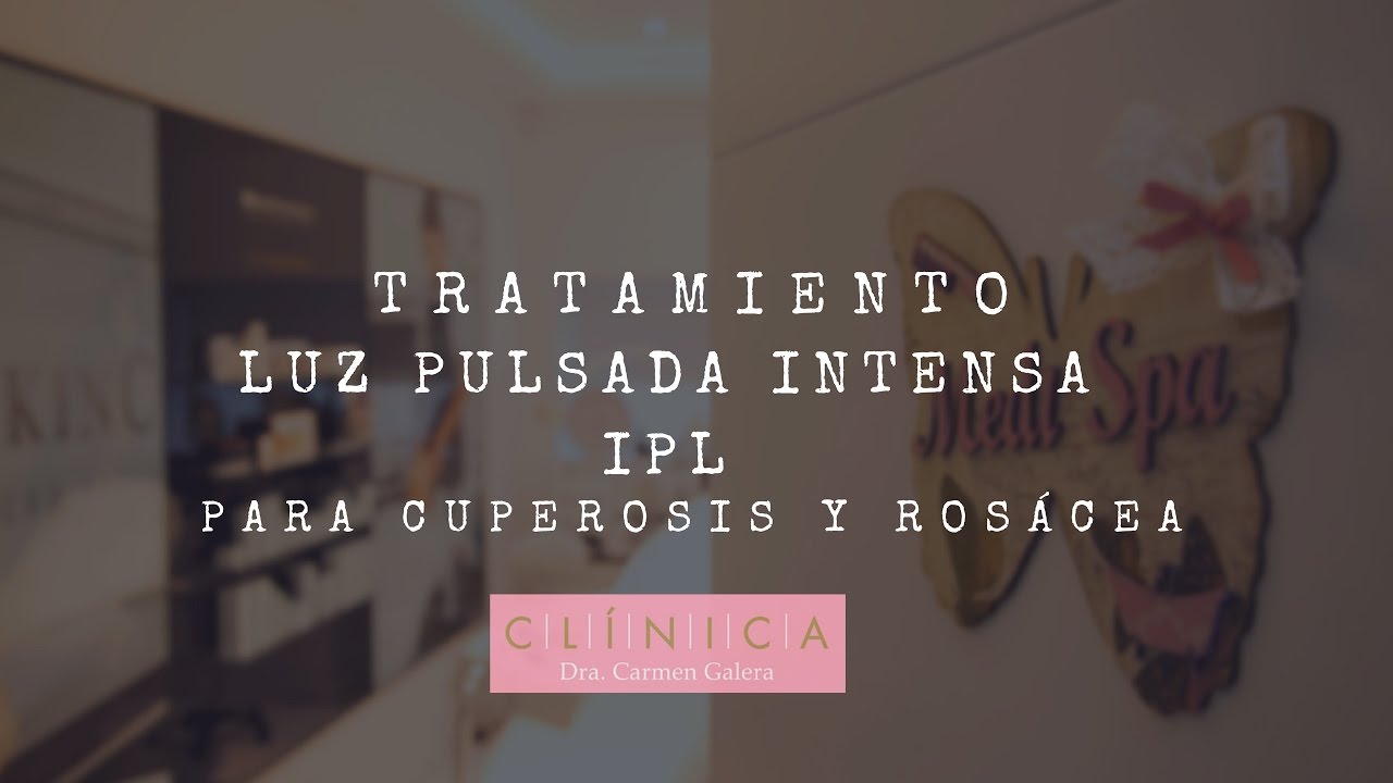 Tratamiento con laser ipl para cuperosis y rosácea YouTube