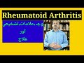 Rheumatoid Arthritis::Causes, Symptoms , Diagnosis and Treatment