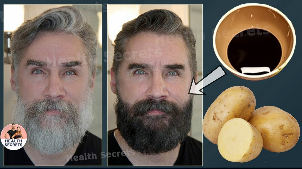 From White to Black Hair with natural remedies in just 5 minutes forever! Gray hair treatment