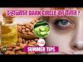 उन्हाळ्यात Dark Circles पासून वाचण्यासाठी हे उपाय नक्की करा। Dark circles | Beauty Tips | Majja Pink
