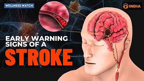Early warning signs of a Stroke | Wellness Watch