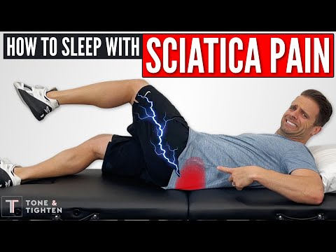 How to Sleep with Sciatica – City Mattress