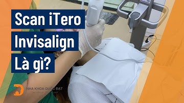 Scan iTero Invisalign là gì? - Nha khoa Quốc Đạt