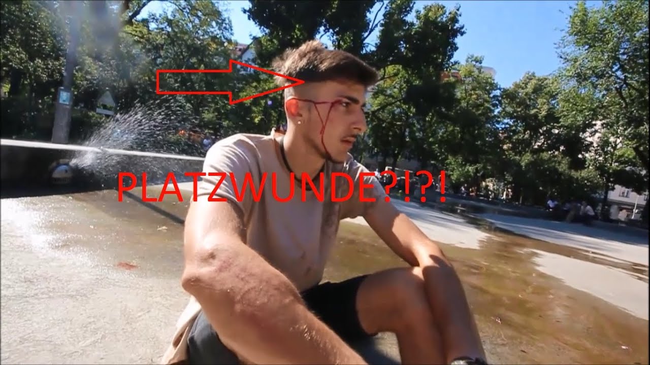 BMX FACEPLANT?! LEGITBMX IN BERLIN pt. 1