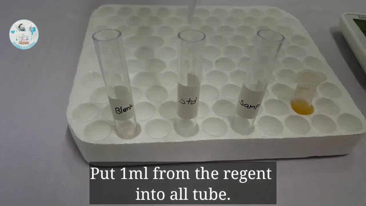 blood-glucose-test-procedure-youtube