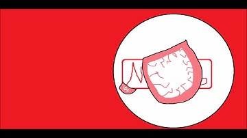 E3 2017 In a nutshell