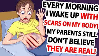 Every Morning I Wake Up With Scars On My Body. But My Parents Still Don&#39;t Believe They ARE REAL!