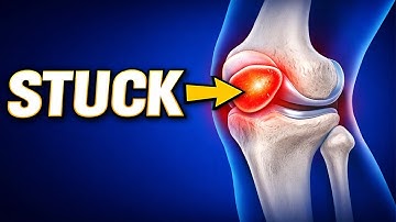 Make Your Knees Feel 20 Years Younger By Fixing This One Thing | Dr. Mandell