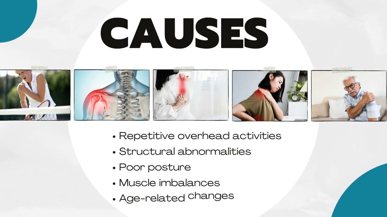 Shoulder impingement