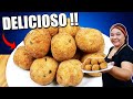 Esse Bolinho de Batata é DELICIOSO  e MUITO FÁCIL de Fazer !! Cozinha sem misterio !