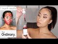 The Ordinary Peeling Solution | 1 Month Use