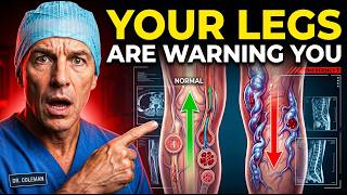 Why Your Varicose Veins Keep Coming Back (Most Doctors Miss This)