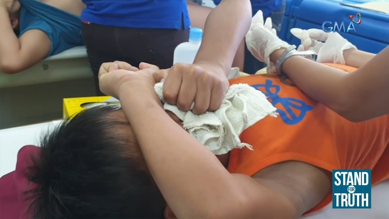 Stand for Truth: Pagpapatuli, kailangan pa ba?