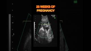 23 Weeks Pregnancy Sonography: Baby's Growth Milestones & Mom's Journey #shortsfeed #mother #shorts