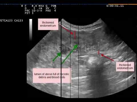 Video: Canine pericardial sykdom