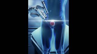 CIRURGIA ROBOTICA PRECISÃO QUE FAZ DIFERENÇA
