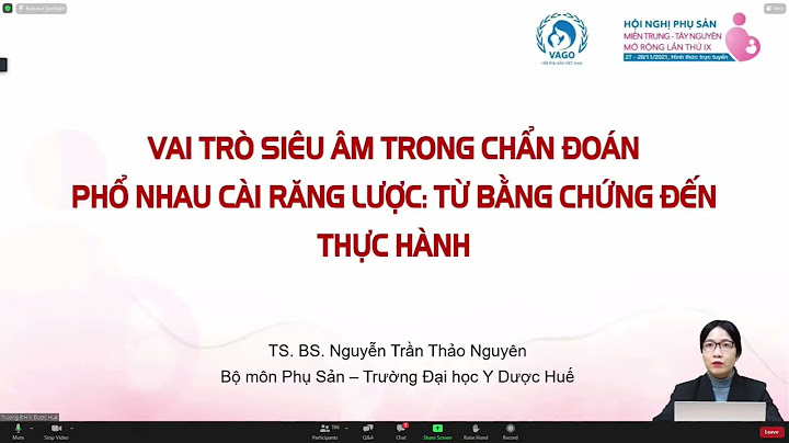 Cài giăng lược trong xây dựng là gì