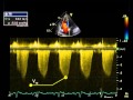 14. Estimating right ventricular / pulmonary artery systolic pressure from TR jet