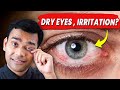 Natural Remedies For Dry Eyes , Irritation And Red Eyes - Dr. Vivek Joshi