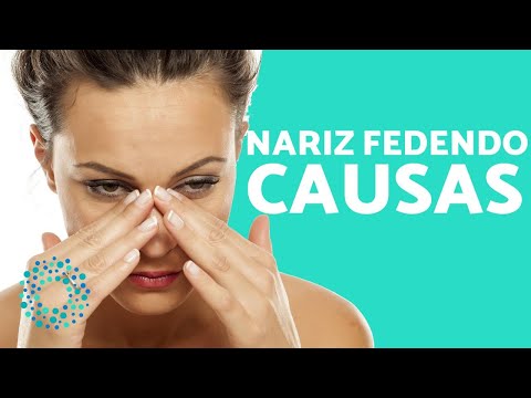 Vídeo: Mau Cheiro No Nariz: Causas, Tratamento E Medidas Preventivas