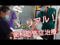 【歯科のリアル】重度歯科恐怖症のための静脈内鎮静法の診療風景／歯医者が怖い、苦手、痛いのが嫌な方向けの無痛麻酔治療／代々木の歯医者・マリコ歯科クリニック協力