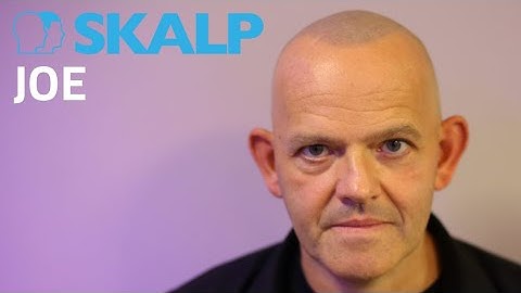 Joe talks about his scalp micropigmentation with Skalp®