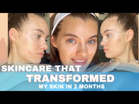 HOW I TRANSFORMED MY SKIN IN 2 MONTHS, every product that made it ...