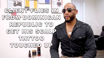 Scalp Micropigmentation Touch Up