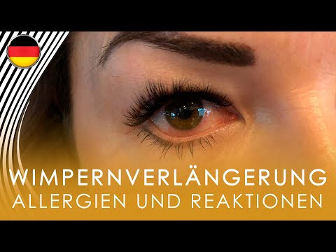 Allergien und Reaktionen auf die Wimpernverlängerung. Geschwollene Augen. Rote Augen. #yaLASHesCLUB