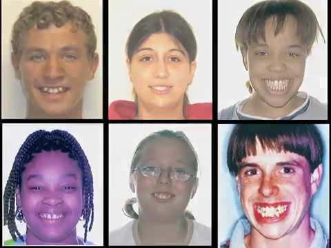 Changing Live Program Smiles Change Lives - program overview - YouTube