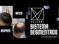 Prótesis capilar para coronilla