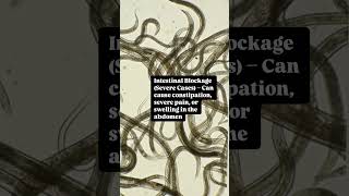 Do You Have Roundworms? #Roundworm #StomachWorms #ParasiteInfection #guthealth