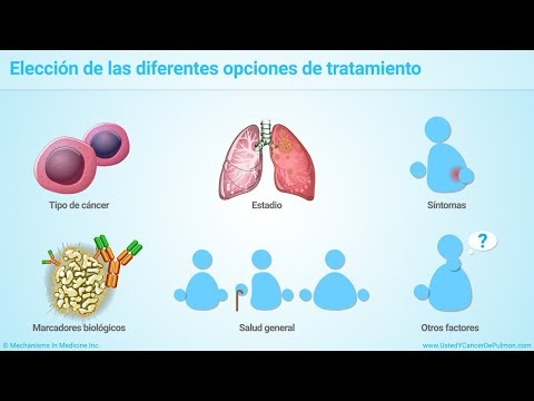 Vídeo: Carcinoma De Pulmón De Células Escamosas: Tratamientos, Estadificación, Síntomas