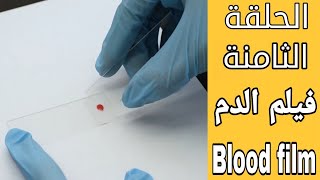 فيلم الدم | الحلقه التاسعه من حلقات صوره الدم الكامله مانيوال