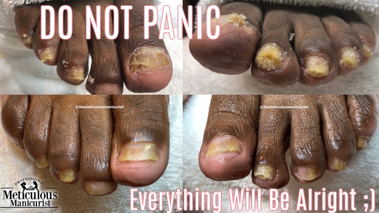 Manicures & Pedicures - DocMartins Foot & Ankle Clinics
