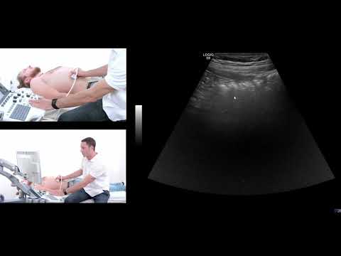 How to perform an ultrasound exam of the gastrointestinal (GI) tract.
