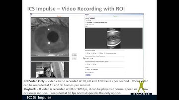 ICS Impulse - Monocular Video Frenzel
