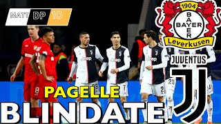 Blindate Demiral Pagelle Bayer Leverkusen Juventus