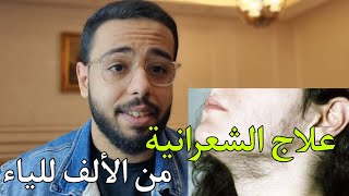 طريقة علاج الشعرانية من الألف للياء بطريقة علمية