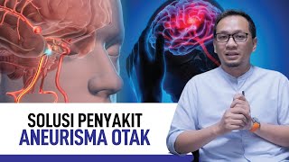 Aneurisma Otak: Penyebab, Gejala, dan Penanganannya | Kata Dokter