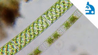 Celebrity Algae Corner: "What Is It?" - Elephant Snot / Mougeotia Wealth