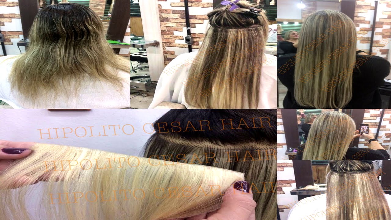 Maquina DIGITAL de implantar cabelo