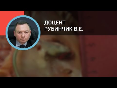 Видео: Измерения от сердца до позвоночника для выявления увеличения левого предсердия у собак с митральной недостаточностью