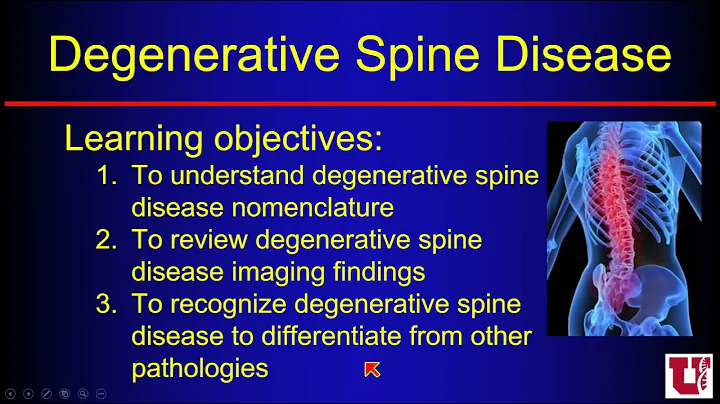 Degenerative Spine Disease: Nomenclature by Richar...