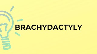 What Is The Meaning Of The Word Brachydactyly?