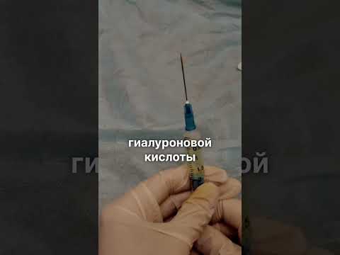 Правда ли, что косметические средства с гиалоурановой кислотой разглаживают морщины?