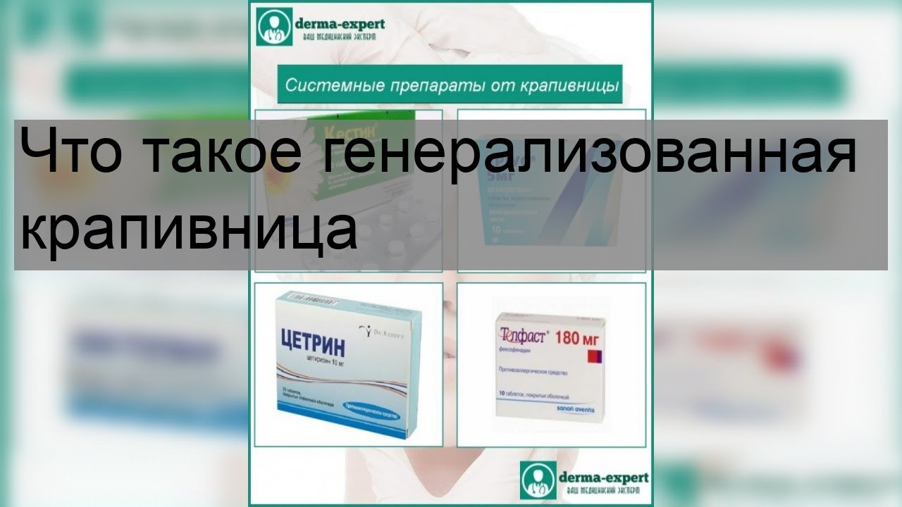 Что такое генерализованная крапивница - YouTube